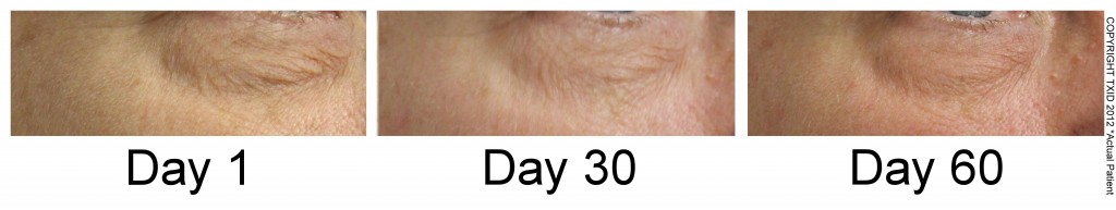 San Antonio Dermatologist Wrinkle Reduction