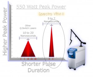 Spectra laser