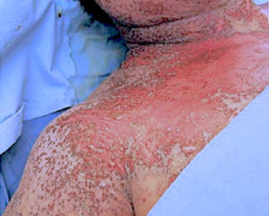 Rash Doctor in San Antonio